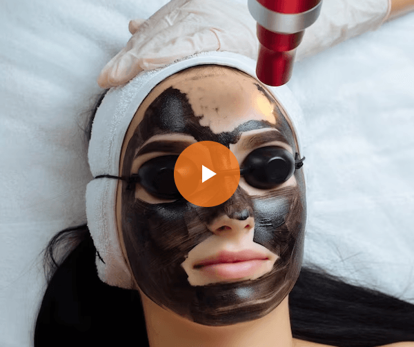 carbon-peel-video