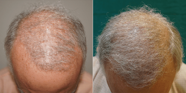 feature image result