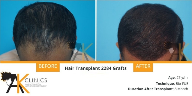 bio-fue-result