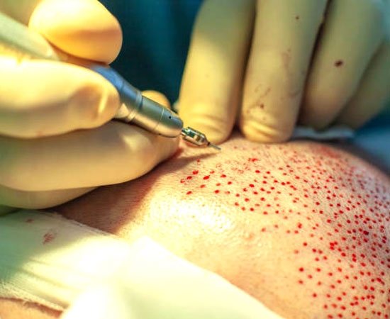 Recipient-Site-Creation-Slit-making