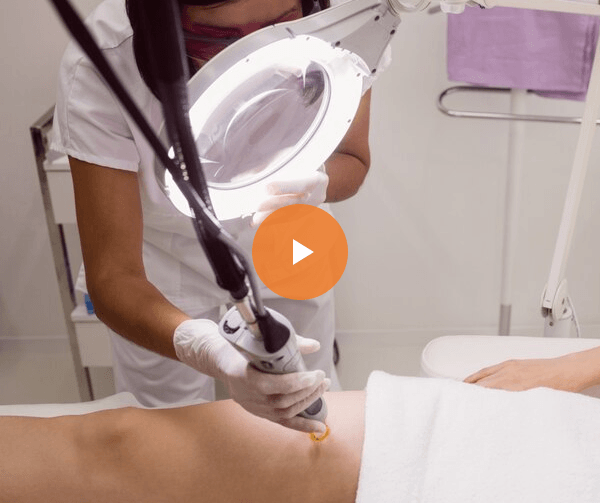 video-img-Laser-Vagninal-Rejuvenation