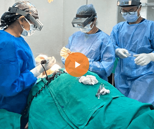 Hair transplant surgery at AK Clinics