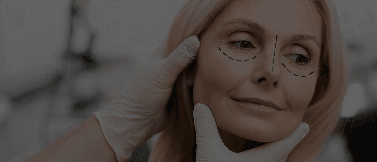 Blepharoplasty Surgery