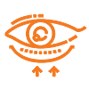 Blepharoplasty