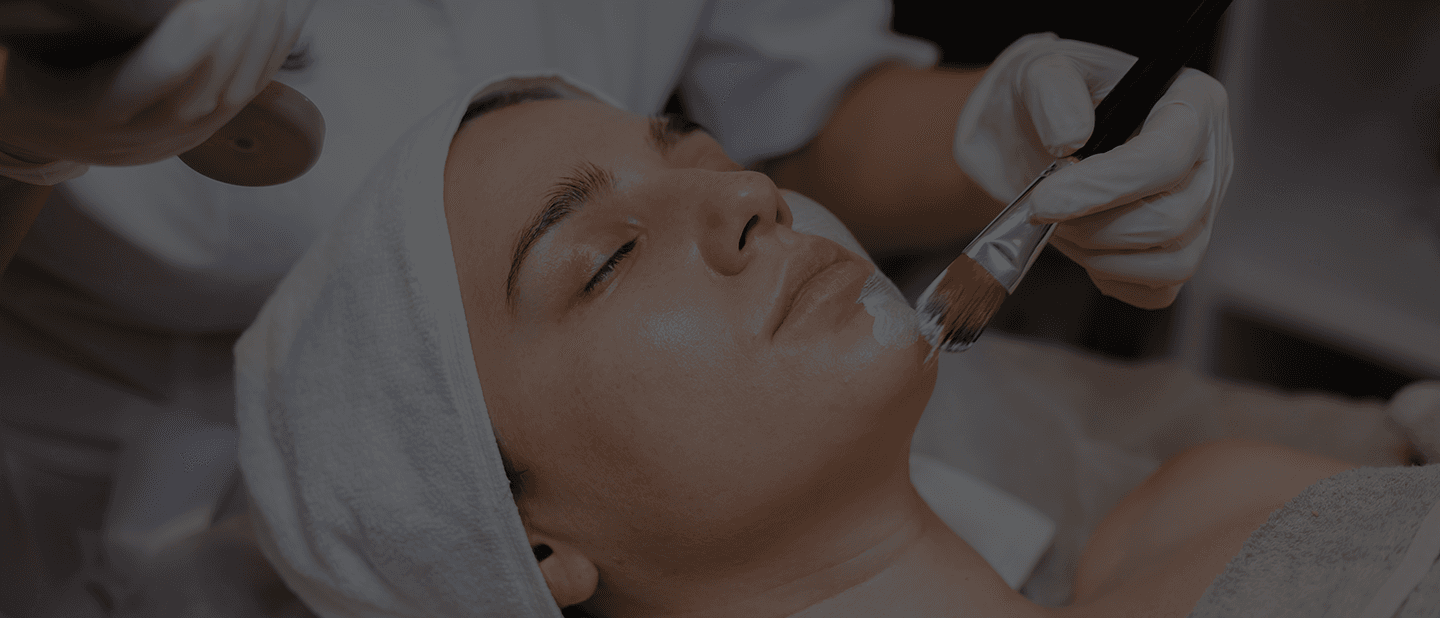 Chemical Peels