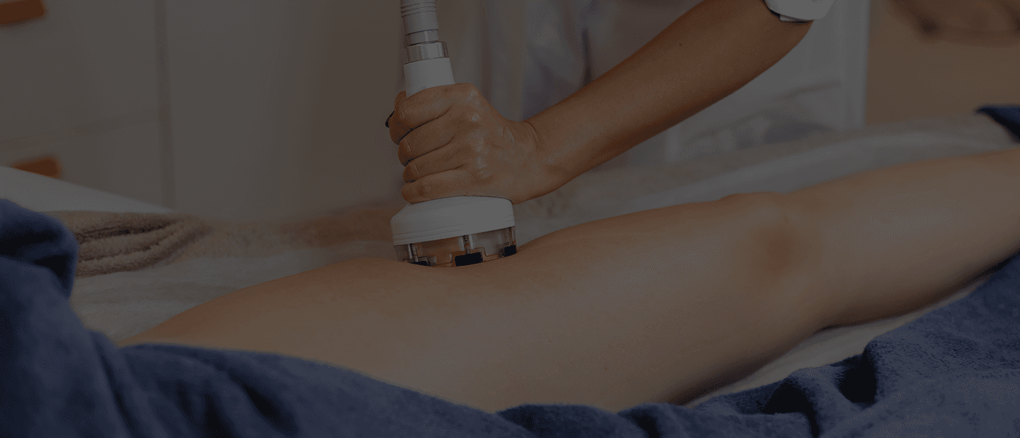 Laser Vagnial Rejuvenation
