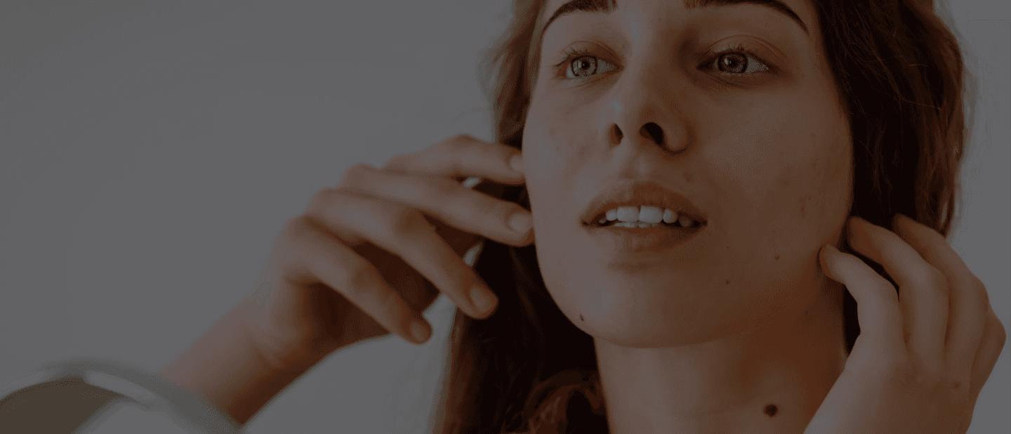 Chemical Peels Post Care