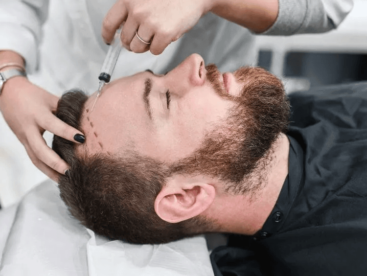 bio-fue<sup>tm</sup> hair transplant