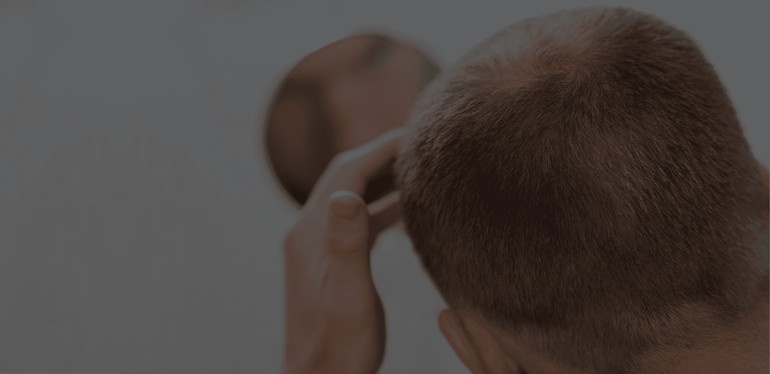 Hair Loss Treatment