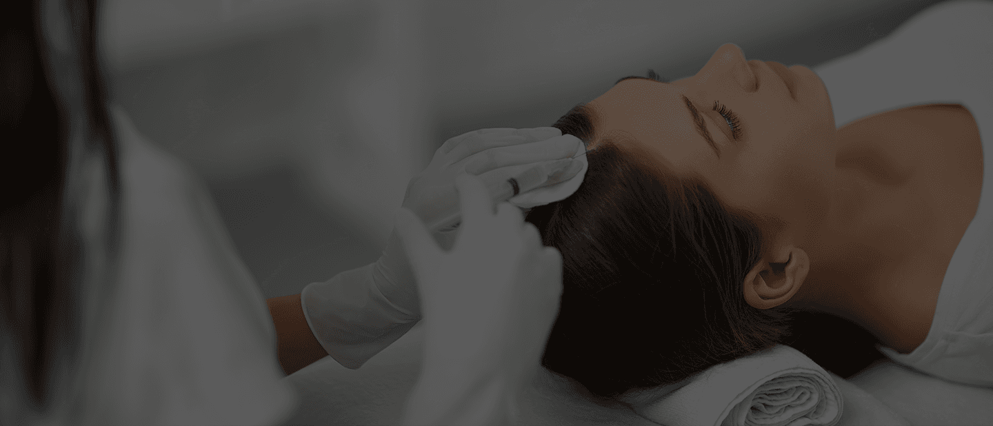 Women Hair Transplant