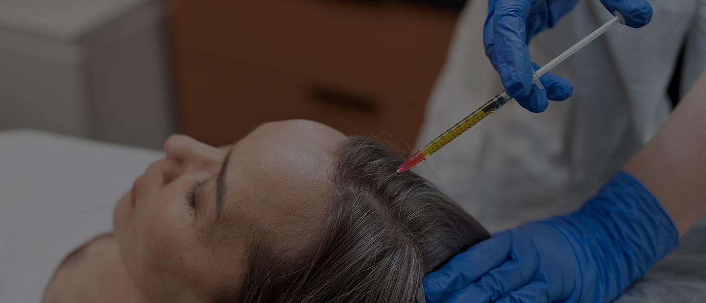 PRP Hair Treatment