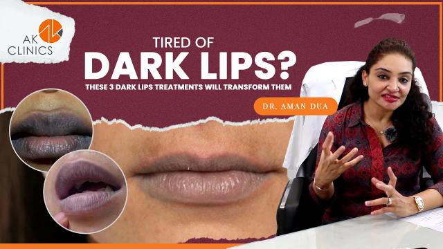 Tired of Dark Lips? These 3 Dark Lips Treatments Will Transform Them