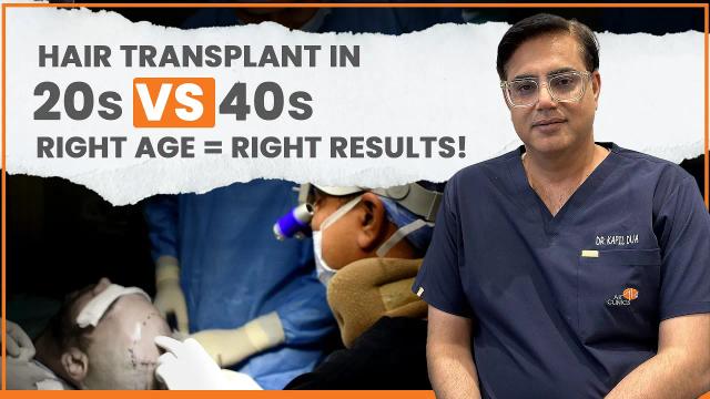 Hair Transplants in Your 20s vs 40s: Why Age Matters?