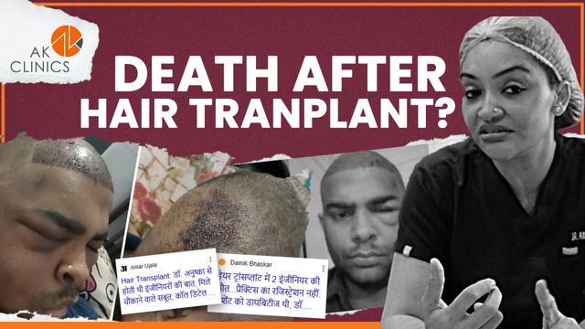 Hair Transplant Death? Kanpur Case by Dr. Aman Dua | What Every Patient Must Know