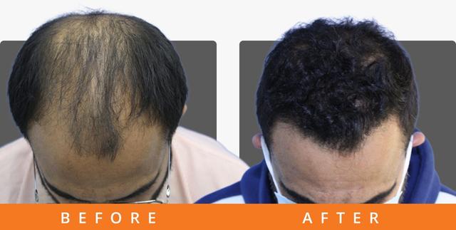 ht-result-bangalore-R6