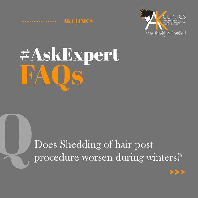 blog-post-img-1-300×170