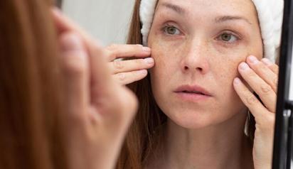 Pigmentation-treatment