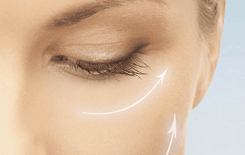 face lift radio frequency &#8211; Copy