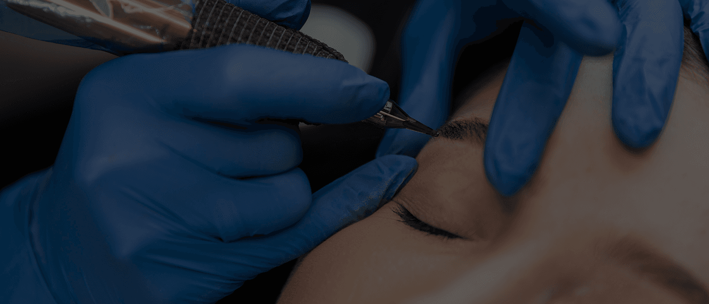 Facial-Hair-Transplant