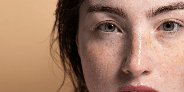 Pigmentation-Treatment-v2