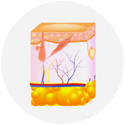 Laser Hair Removal Step - 3