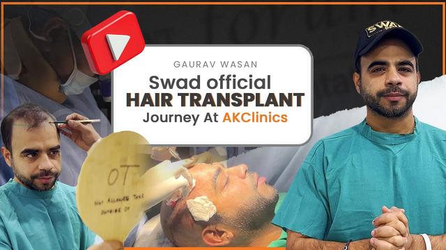 Gaurav Wasan Hair Transplant Journey