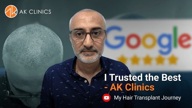 Hair Transplant by Dr. Kapil Dua