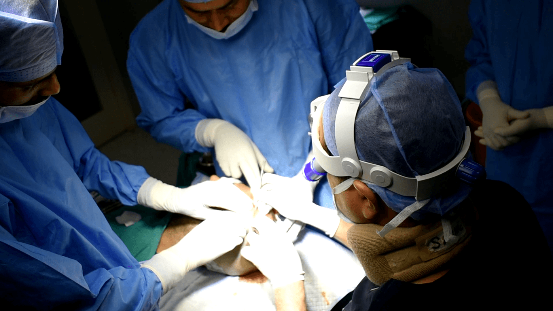 hair-transplant-training-session-1