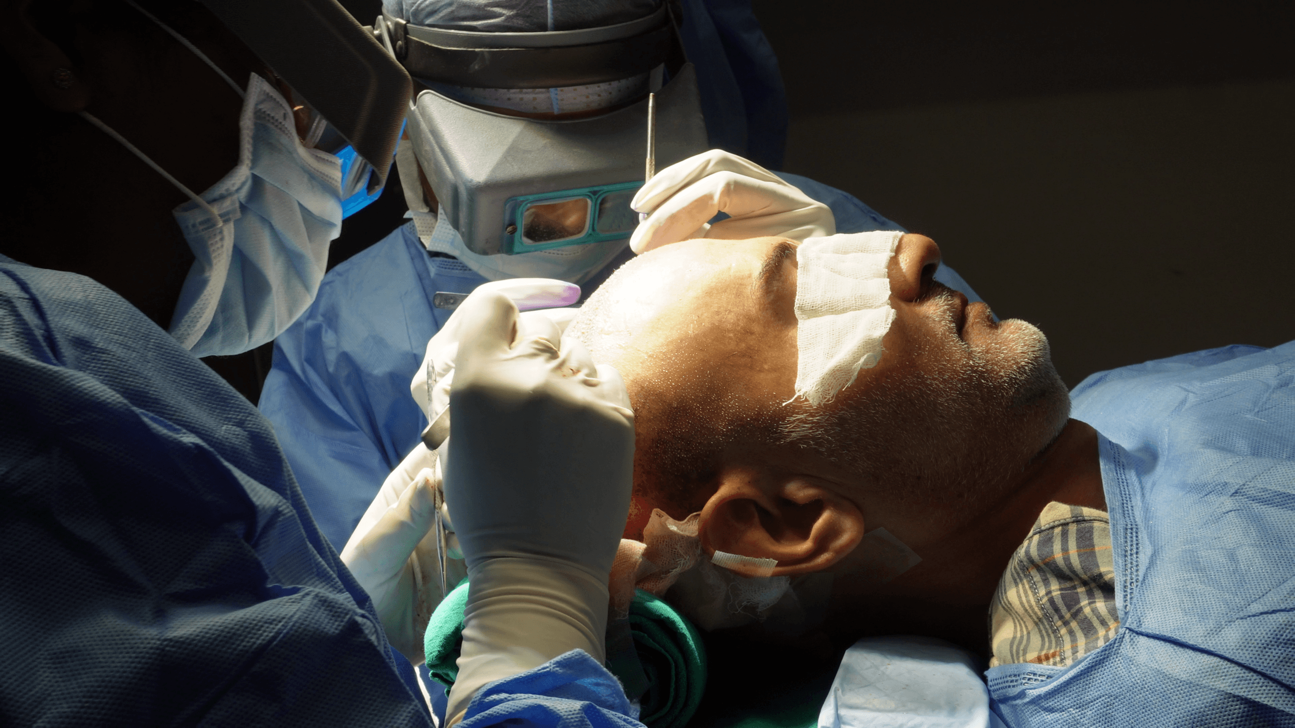 hair-transplant-training-session