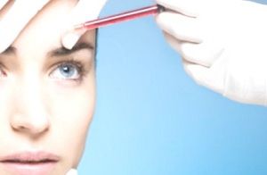 laser hair removal - faq