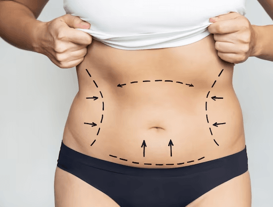 laser hair removal - faq
