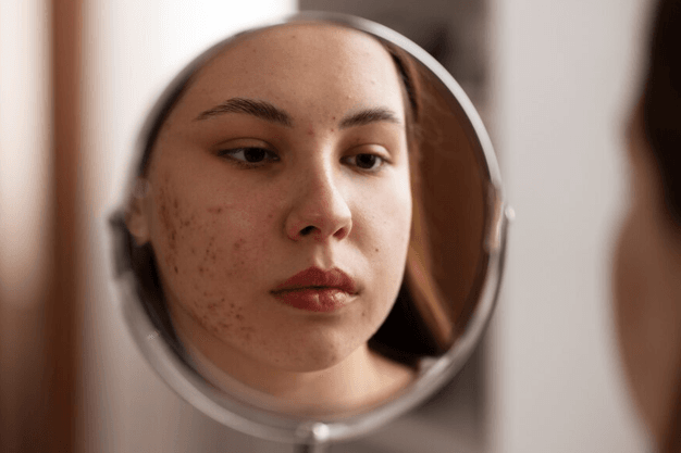 laser hair removal - faq