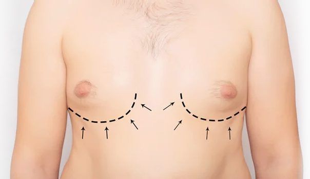 laser hair removal - faq