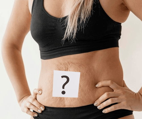 laser hair removal - faq