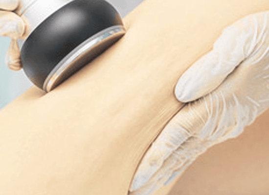 laser hair removal - faq