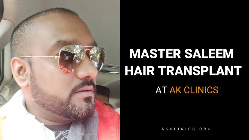 Master Saleem - Celebrity Hair Transplant | Dr Kapil Dua