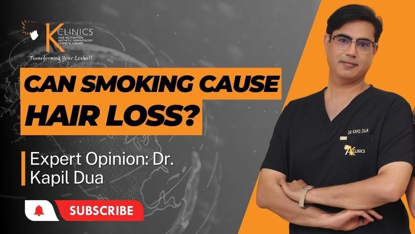 Can Smoking Cause Hair Loss? | Expert's Opinion- Dr. Kapil Dua