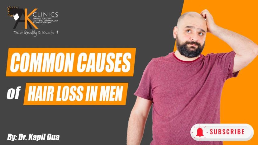 Understanding the Common Causes of Hair Loss in Men - Dr Kapil Dua