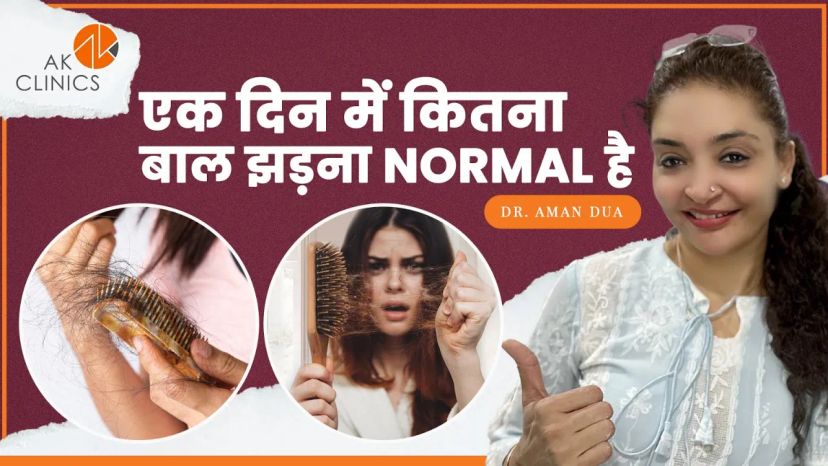 एक दिन मे कितना बाल झड़ना Normal है ? How Much Hair Fall Per Day | Dr. Aman Dua