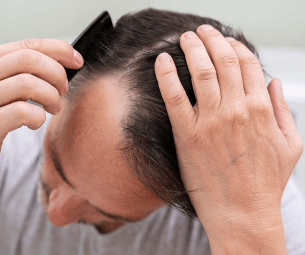 laser hair removal - faq