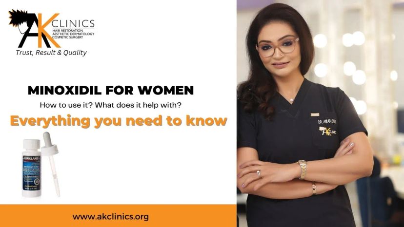 Minoxidil-for-Female