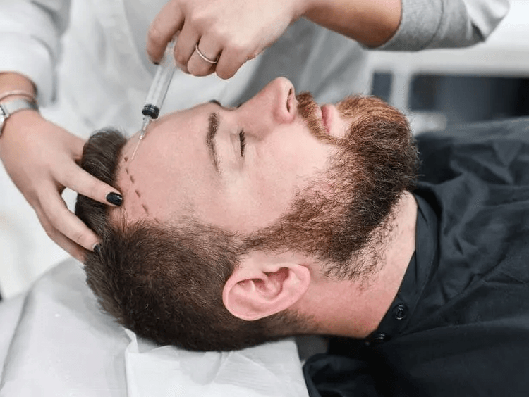 Bio FUE Hair Transplant