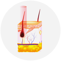 Laser Hair Removal Step - 2