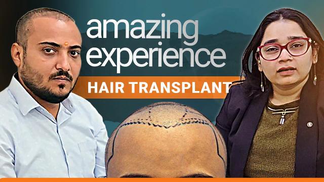 15 days post hair transplant experience