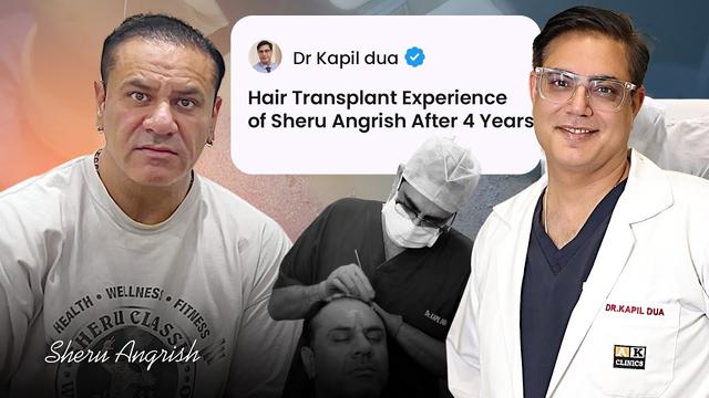 Sheru Angrish hair transplant