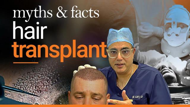 hair transplant myths