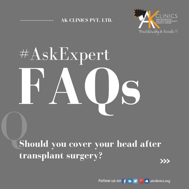 blog-post-img-1-300×170