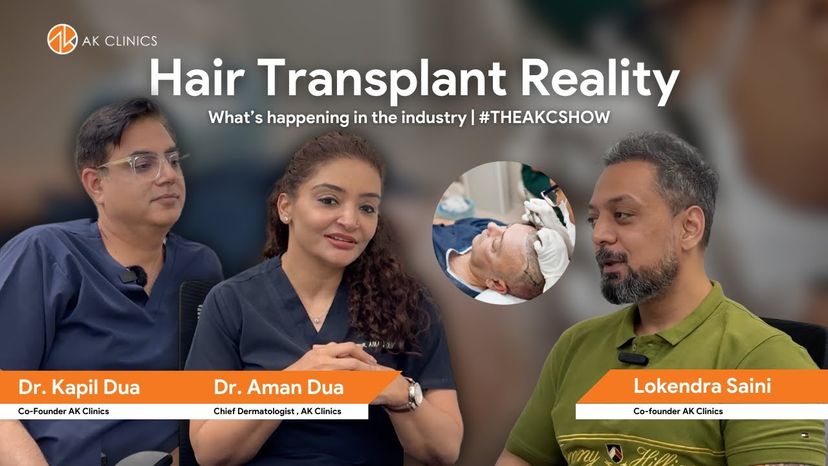 hair transplant in delhi