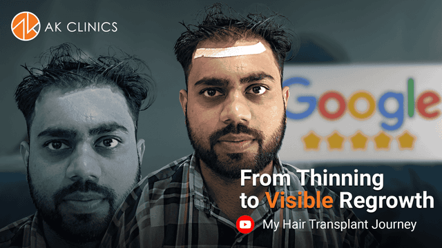 PRP result After 3rd Session