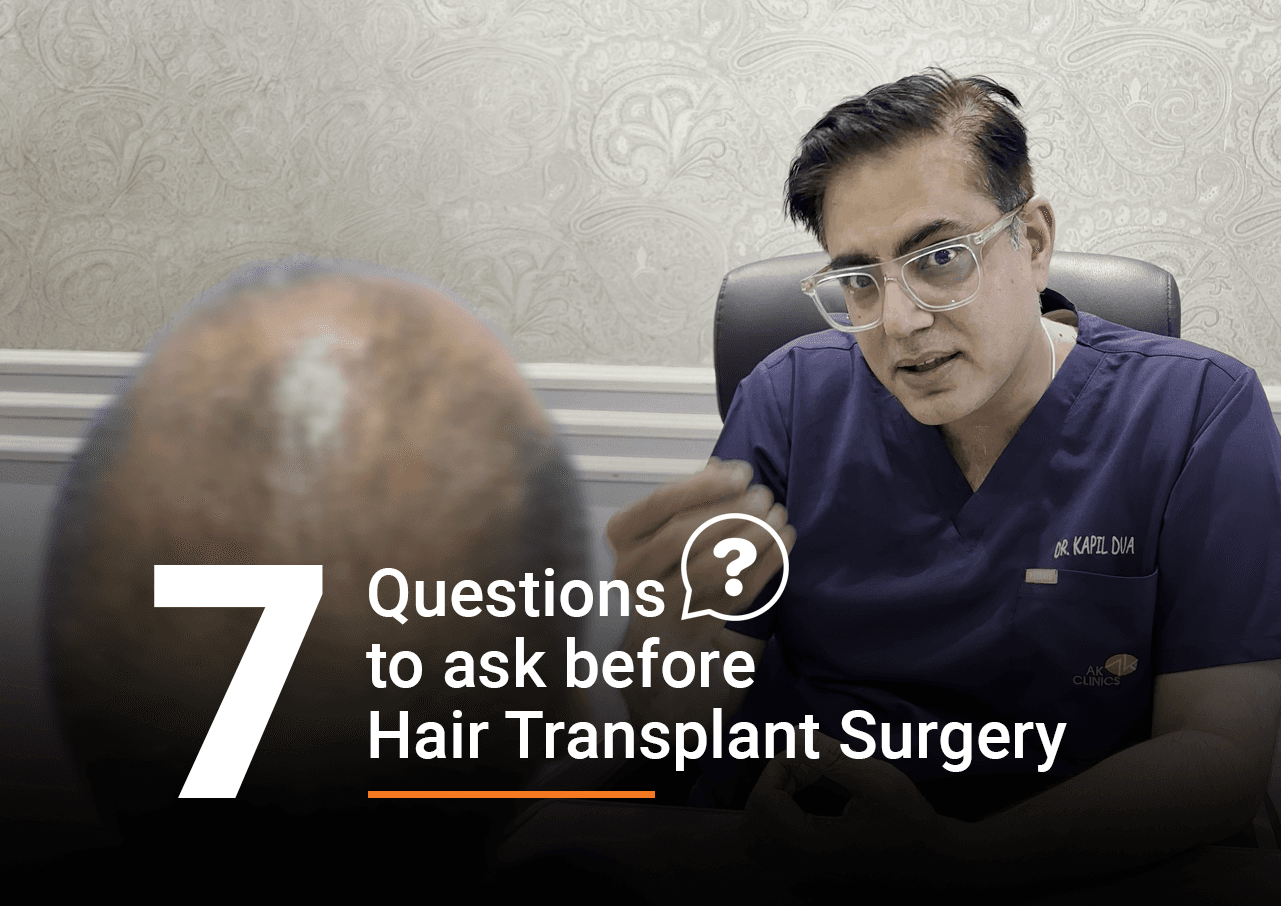 7 important questions to ask about hair transplant